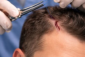 Całodobowa opieka chirurgiczna dla mieszkańców gminy Radwanice