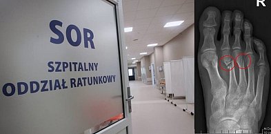 Tak się dziś łamaliśmy. Podsumowanie dnia na SOR-ze