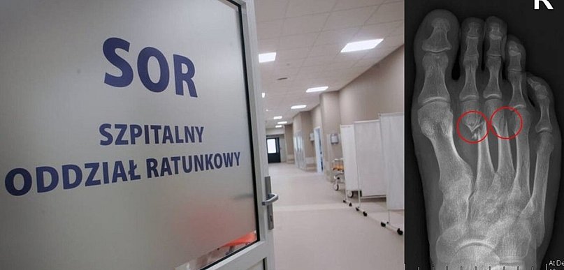 Tak się dziś łamaliśmy. Podsumowanie dnia na SOR-ze